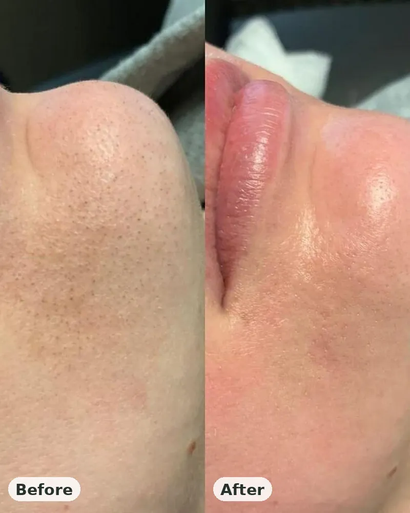 Before and after: brighter, more even skin